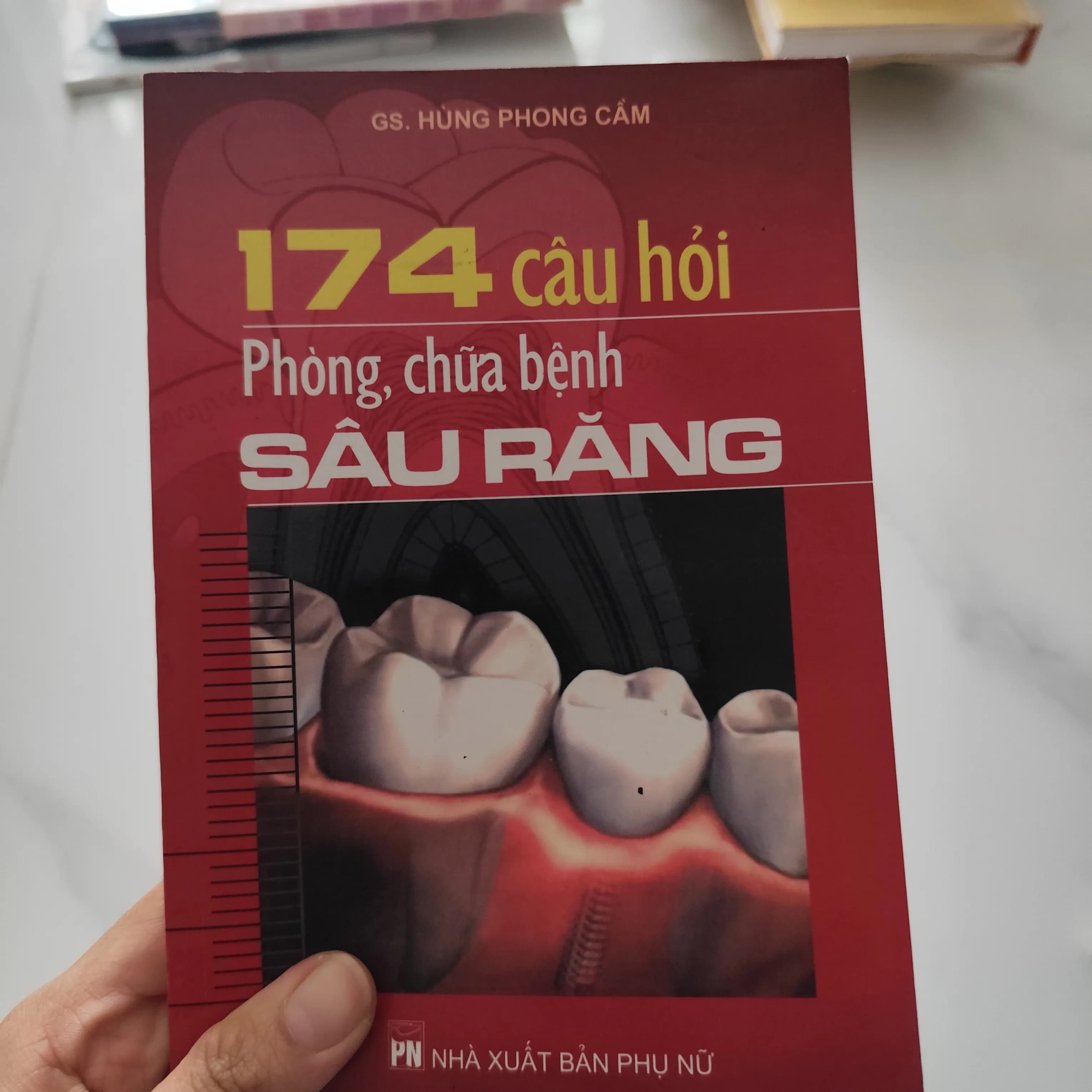 174 câu hỏi phòng, chữa bệnh sâu răng - Image 1